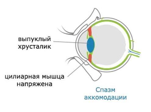 Аккомодация глаза