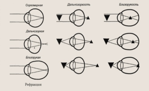 Рефракция